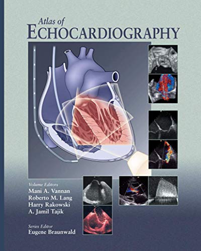 Stock image for Atlas of Echocardiography for sale by HPB-Diamond