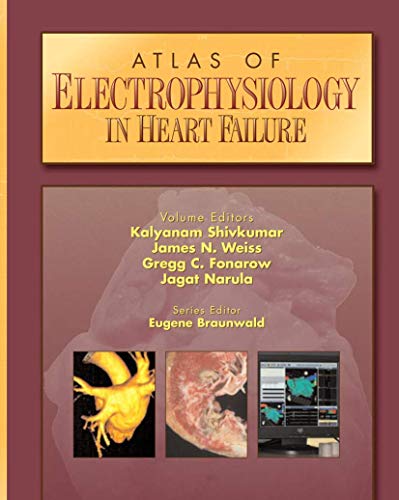 Imagen de archivo de Atlas of Electrophysiology in Heart Failure a la venta por HPB Inc.