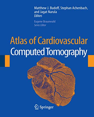 Stock image for Atlas of Cardiovascular Computed Tomography for sale by ThriftBooks-Atlanta