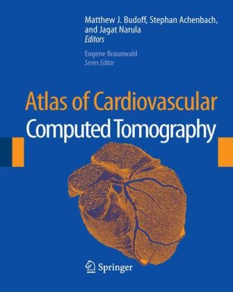 Stock image for Atlas of Cardiovascular Computed Tomography : includes narrated videos for sale by Buchpark