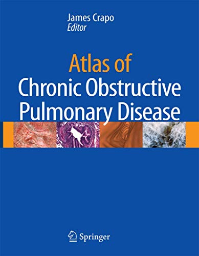 Beispielbild fr Atlas of Chronic Obstructive Pulmonary Disease zum Verkauf von Solr Books