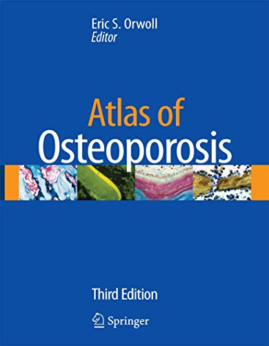 Imagen de archivo de Atlas of Osteoporosis a la venta por Better World Books