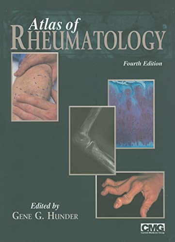 Stock image for Atlas of Rheumatology for sale by Books Puddle