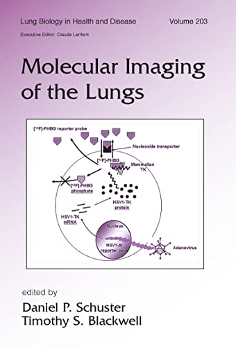 Stock image for Molecular Imaging Of The Lungs for sale by Basi6 International