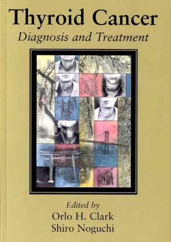 9781576261163: Thyroid Cancer: Diagnosis And Treatment
