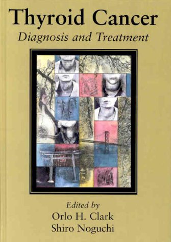 Imagen de archivo de Thyroid Cancer. Diagnosis and Treatment. a la venta por CSG Onlinebuch GMBH