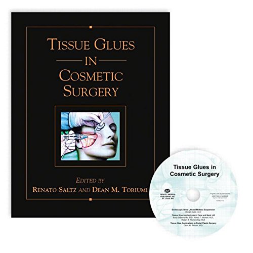 Beispielbild fr Tissue Glues in Cosmetic Surgery zum Verkauf von Amazing Books Pittsburgh