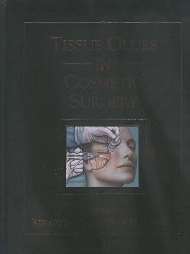 9781576261743: Tissue Glues in Cosmetic Surgery