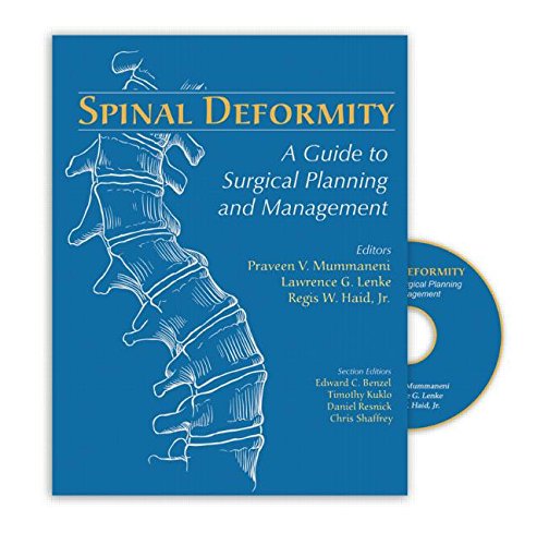 Beispielbild fr Spinal Deformity: A Guide to Surgical Planning and Management zum Verkauf von Salish Sea Books