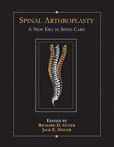 9781576261903: Spinal Arthroplasty: A New Era in Spine Care