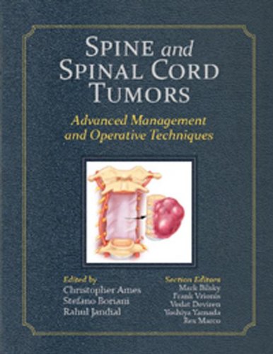 Beispielbild fr Spine and Spinal Cord Tumors: Advanced Management and Operative Techniques zum Verkauf von Mispah books