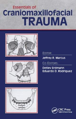 9781576263327: Essentials of Craniomaxillofacial Trauma