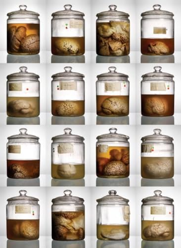 Stock image for Malformed: Forgotten Brains of the Texas State Mental Hospital for sale by dsmbooks