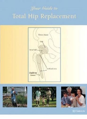 Beispielbild fr Your Guide to Total Hip Replacement zum Verkauf von Foggy Mountain Books