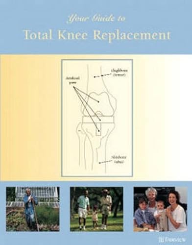 Beispielbild fr Your Guide to Total Knee Replacement zum Verkauf von Better World Books