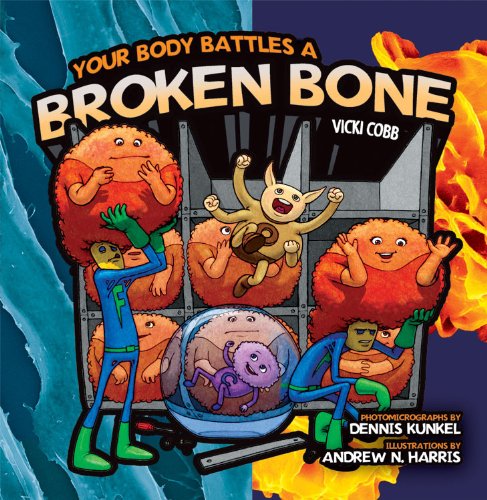 Stock image for Your Body Battles a Broken Bone for sale by Half Price Books Inc.