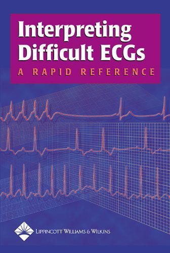 Stock image for Interpreting Difficult ECGs: A Rapid Reference for sale by Reliant Bookstore
