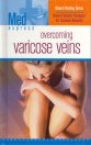 9781582799728: Me - Overcoming Varicose Veins (Med Express)