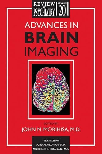 Beispielbild fr Advances in Brain Imaging (Review of Psychiatry) zum Verkauf von HPB-Red