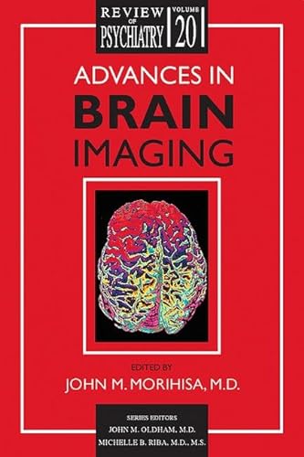 Stock image for Advances in Brain Imaging (Review of Psychiatry) for sale by HPB-Red