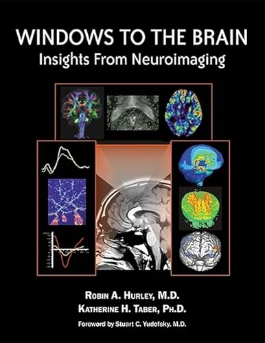 Imagen de archivo de Windows to the Brain: Insights From Neuroimaging [Hardcover] Robin A.; M.D. Hurley; Katherine H. and Ph.D. Taber a la venta por tttkelly1