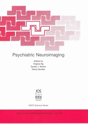 Beispielbild fr Psychiatric Neuroimaging (NATO ASI SERIES) zum Verkauf von Wonder Book