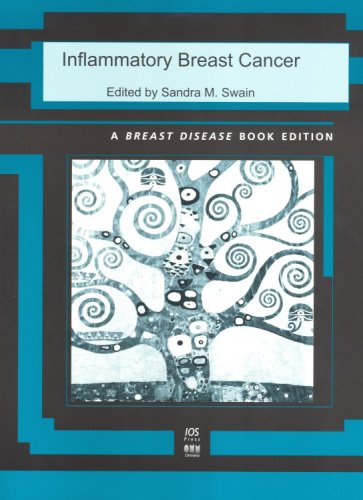 Stock image for Inflammatory Breast Cancer (Breast Disease) for sale by Ergodebooks