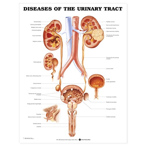 Imagen de archivo de Diseases of the Urinary Tract Anatomical Chart a la venta por GF Books, Inc.