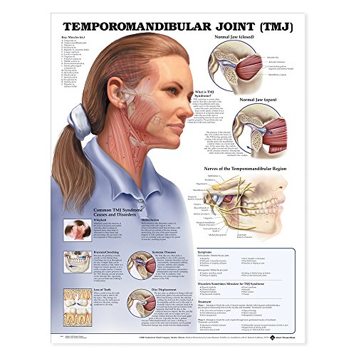 Temporomandibular Joint (TMJ) Anatomical Chart (9781587792960) by Anatomical Chart Company