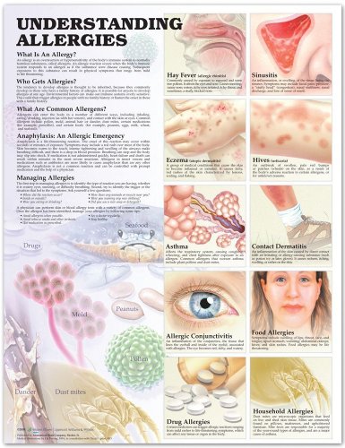 Understanding Allergies Anatomical Chart (9781587793004) by Anatomical Chart Company