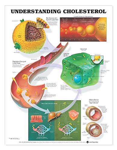 Understanding Cholesterol Anatomical Chart (9781587793264) by Anatomical Chart