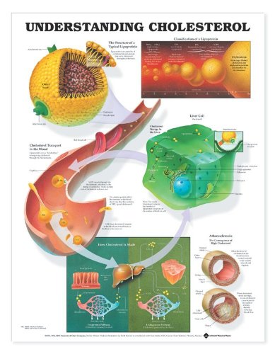 Imagen de archivo de Understanding Cholesterol Anatomical Chart a la venta por Revaluation Books