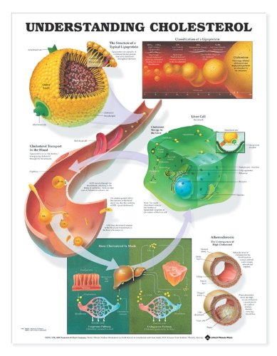 Stock image for Understanding Cholesterol Anatomical Chart for sale by Revaluation Books