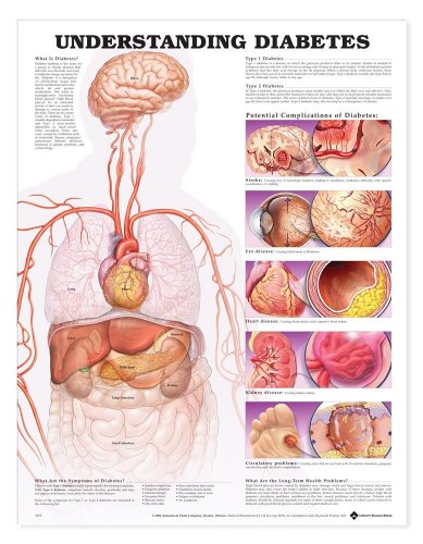 Understanding Diabetes Anatomical Chart (9781587793882) by Anatomical Chart Company