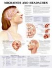 Migraines And Headaches Chart: (laminated) (9781587794889) by ACC