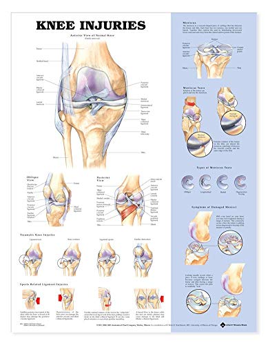 Imagen de archivo de Knee Injuries Anatomical Chart a la venta por Revaluation Books