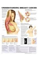 Understanding Breast Cancer Anatomical Chart (9781587797156) by Anatomical Chart Company