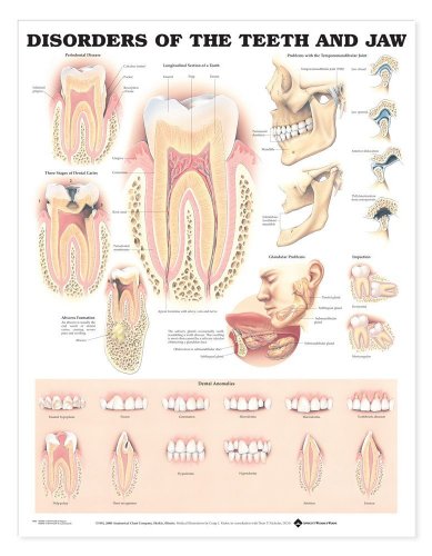 Disorders of the Teeth and Jaw Anatomical Chart (9781587797170) by Anatomical Chart Company