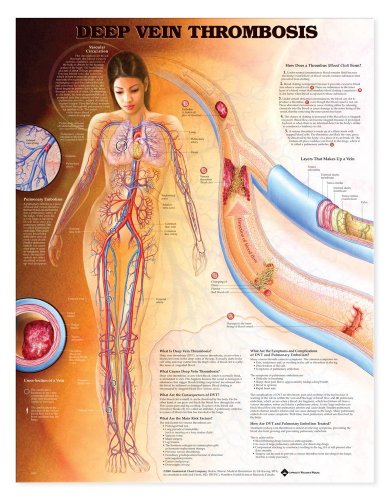 9781587797316: Deep Vein Thrombosis Anatomical Chart