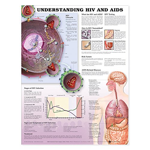 9781587798535: Understanding HIV And AIDS Chart: (laminated)