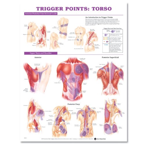 Trigger Points Torso (9781587798627) by Anatomical Chart Company