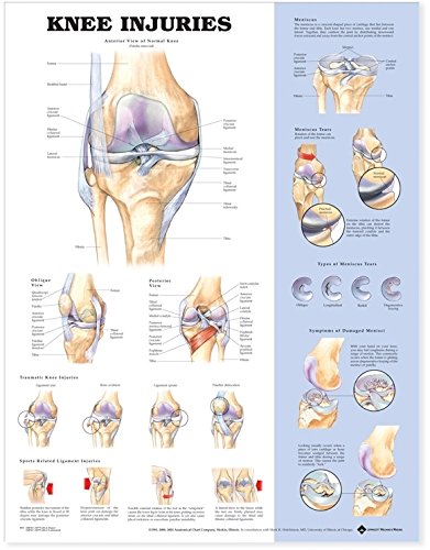 Knee Injuries Anatomical Chart (9781587798917) by Anatomical Chart Company