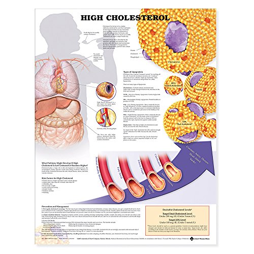 High Cholesterol Anatomical Chart (9781587799105) by ACC