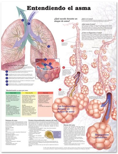 Comprendiendo El Asma / Understanding Asthma Anatomical Chart (Spanish Edition) (9781587799440) by Anatomical Chart Company