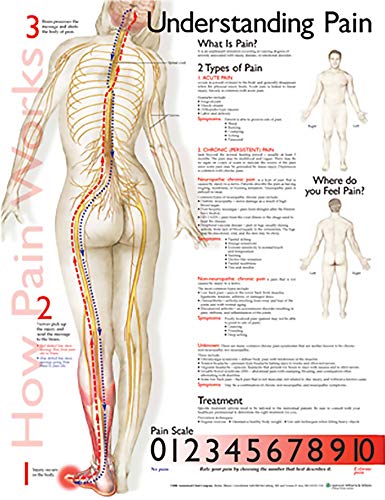 Stock image for Understanding Pain Anatomical Chart (Wall Chart) for sale by Revaluation Books