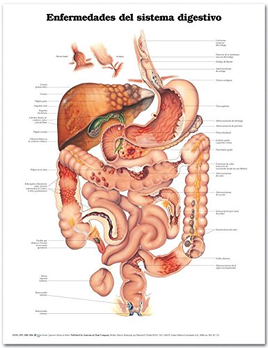 Diseases of the Digestive System Anatomical Chart in Spanish/ Enfermedades Del Sistema Digestivo (Spanish Edition) (9781587799860) by Anatomical Chart Company