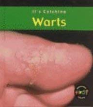 9781588102317: Warts (It's Catching)