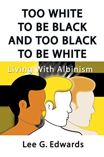 Imagen de archivo de Too White to Be Black and Too Black to Be White: Living with Albinism a la venta por Chiron Media