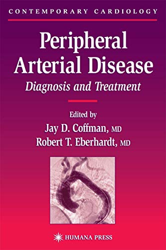 Imagen de archivo de Peripheral Arterial Disease : Diagnosis and Treatment a la venta por Better World Books Ltd