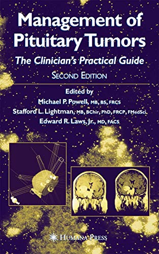 9781588290533: Management of Pituitary Tumors: The Clinician's Practical Guide